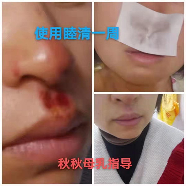 �����澏���N���Æ������M(f��i)�߿ڱ���������(sh��)���a(ch��n)ƷȦ�۟o��(sh��)