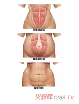 ���������îa(ch��n)���Ŀ-��ֱ���ޏ�(f��)